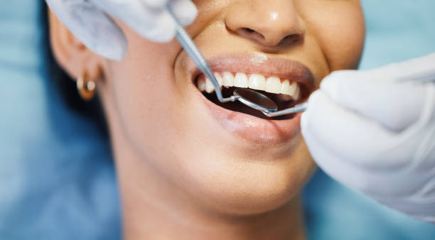 Best Emergency Broken Tooth Repair in West Middlesex, PA