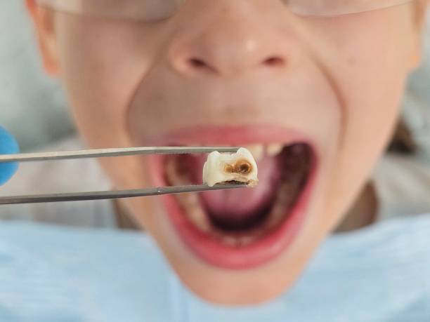 Best After-Hours Emergency Dentist in West Middlesex, PA