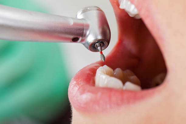 Best Emergency Treatment for Toothache in West Middlesex, PA